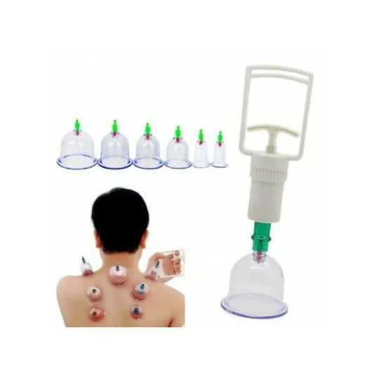 🌿 Σετ Βεντούζες Vacuum 6Τμχ – Φυσική Ανακούφιση Πόνου & Ευεξία